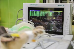 Electrocardiogram (ECG) machine measures the electricity